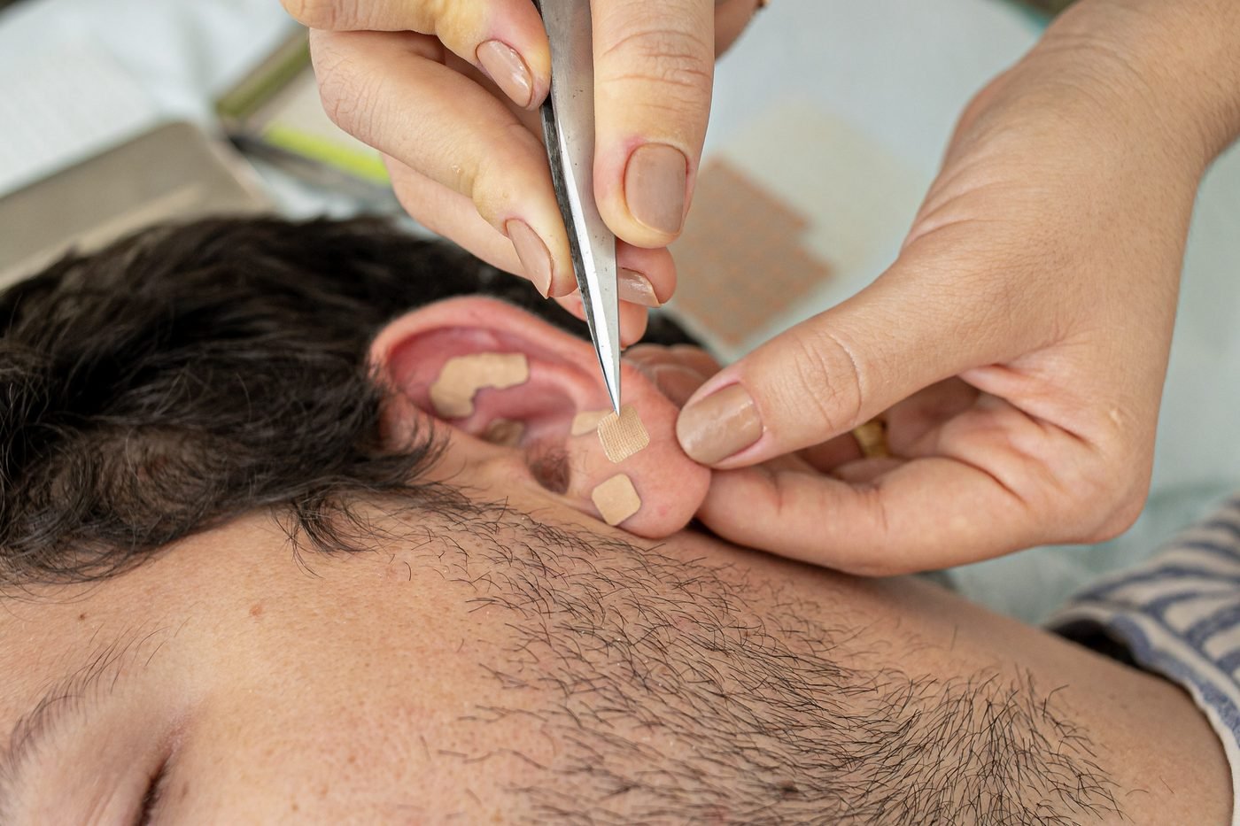 Auriculoterapia na Fisius ITC Vertebral